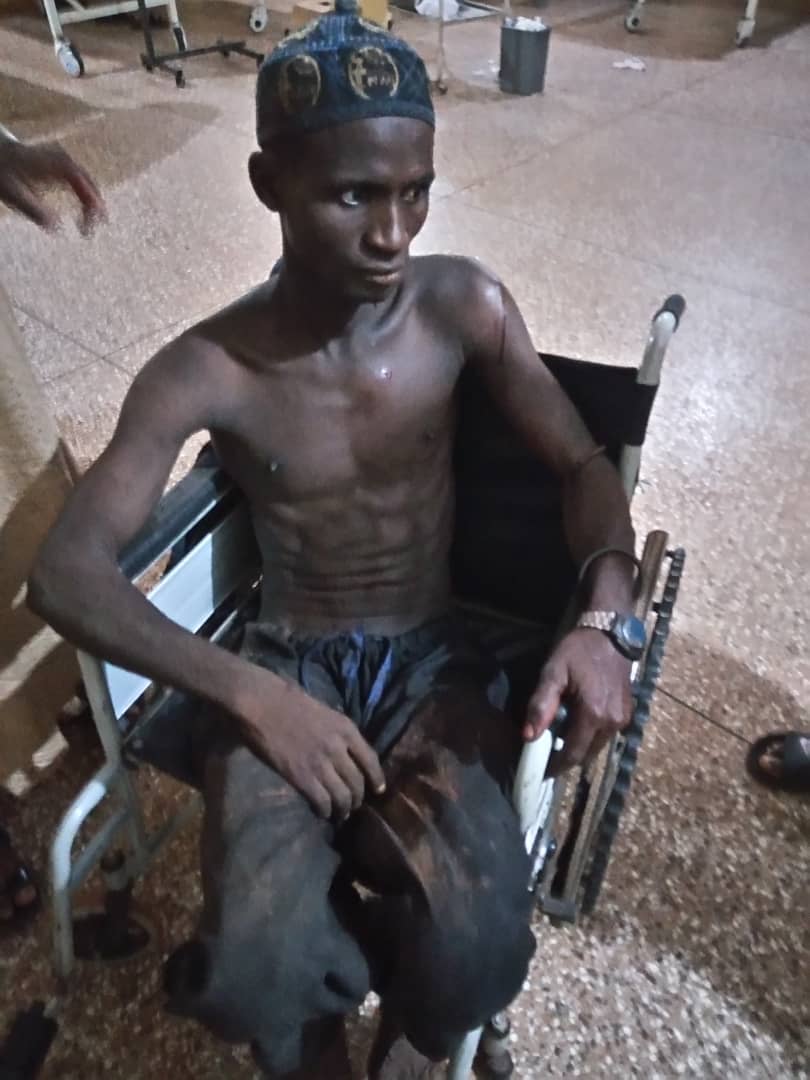 One of the injured herdsmen at the hospital